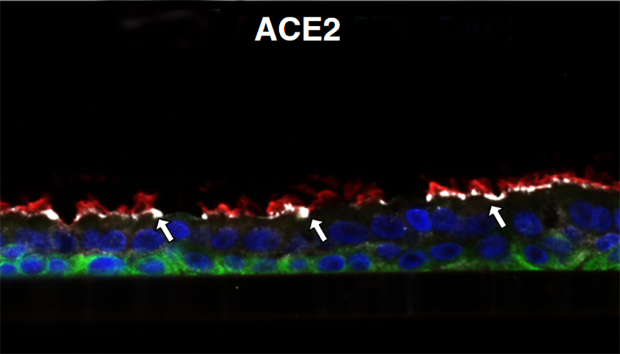 Allergic Inflammation and Viral Infection Change Expression Levels of Genes  Crucial to SARS-CoV-2 Infection