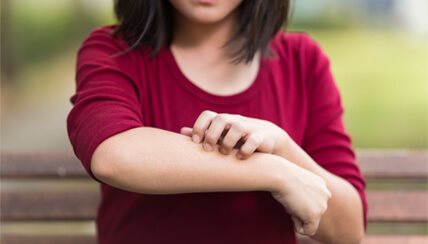 woman scratching her arm